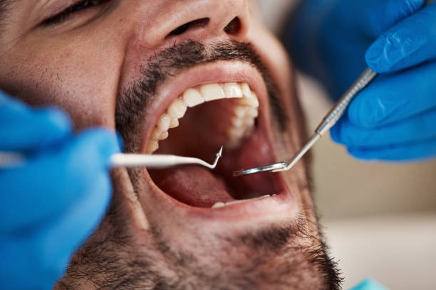 Best Emergency Dental Care for Broken or Chipped Teeth in Burns Flat, OK